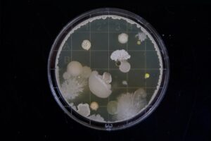 Bacterial cultures in a petri dish