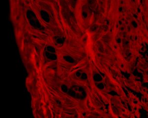Red microscopy image of fibrous tissue